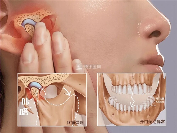 00Ůһ޷죺ȷT M D