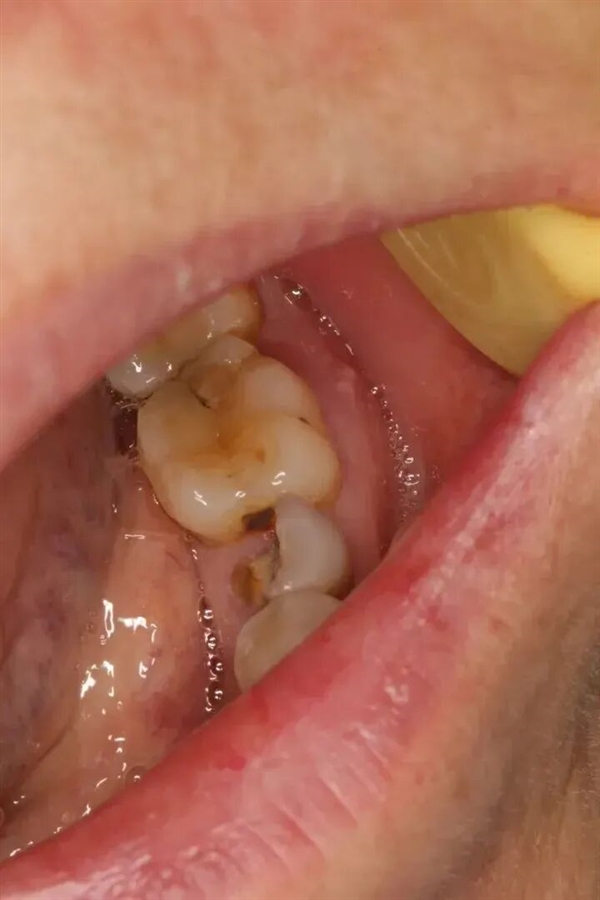 ˲ӵС ؼʱ̿ܰѰ֢Ͽ