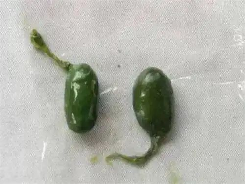 Ů㵨¸˥ ҽԿ˪ ޽ҩ