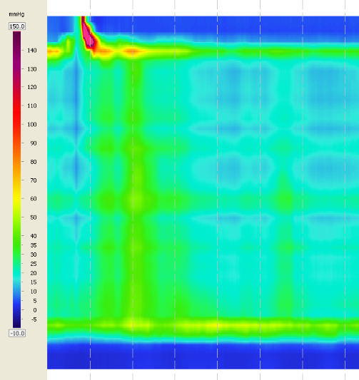 ��4���ź��������ڡ���ȡ� �ܶ��˵����ձ�θ���� ���־�����