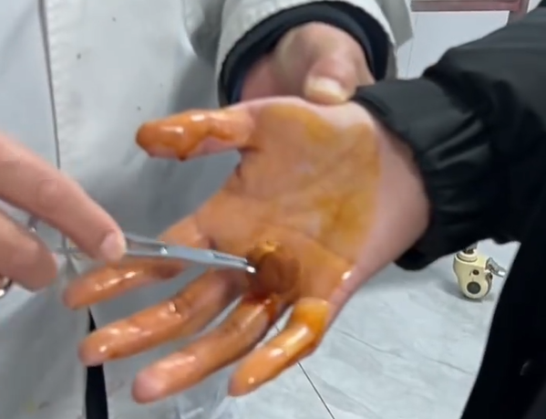 ����ͽ�������̺˫�ֱ��������ۣ�������ʲ�����ά ���պ�ɫ����