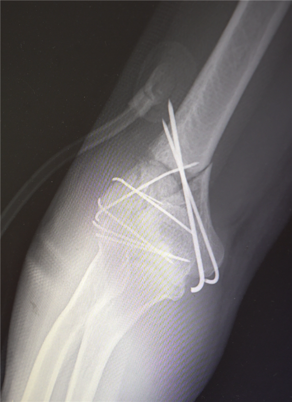 ����13��׹��ˤ��30������ͷ ҽ��ƴͼʽ�����Ȼ�