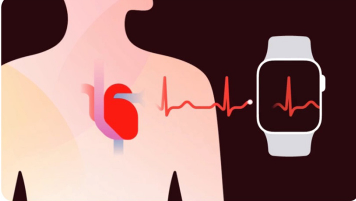 applewatch�ĵ�ͼ��ô��?ƻ���ֱ������ĵ�ͼ�����̳�