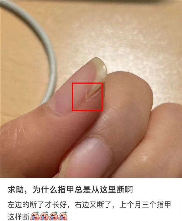 ָ��Ϊʲô�ܴ�����ط��Ͽ� ��ȱ������