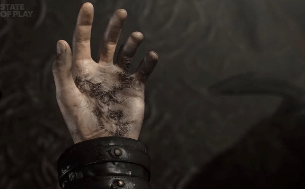 �ﰺΣ���ˣ�������Σ��9����ϸ�ڣ��²���������ֻ����