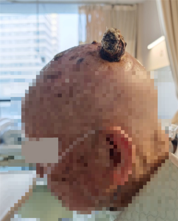 ������97������ͷ������4���׶����׮ ����ǰ���������Ը���