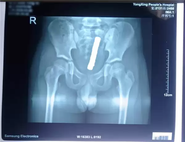 10�꺢�ӽ�8�Ŵ�������������³����ף�С����㲻��