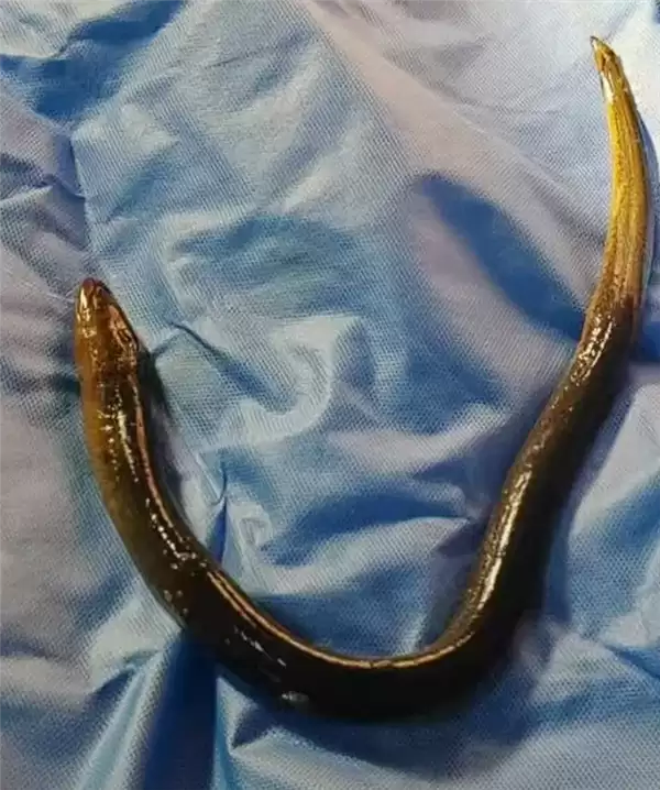 14���к���������������2Сʱ�޷�ȡ�� ҽ����ʮ��Σ�ա�����ģ��