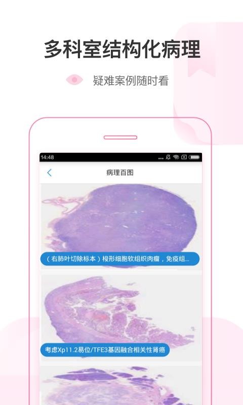 ҽapp 3.8.4